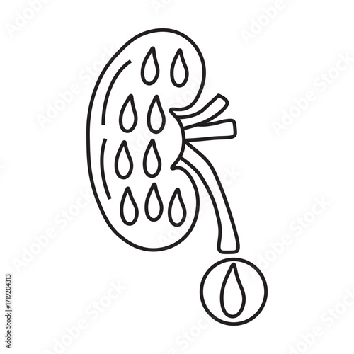 Diabetic Nephropathy