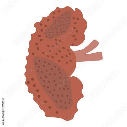 chronic kidney disease