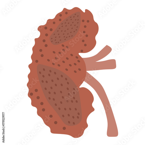 chronic kidney disease
