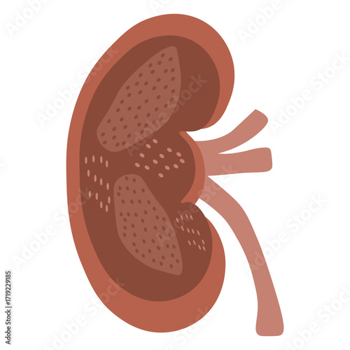chronic kidney disease