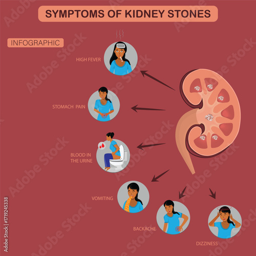 Infographic of kidney stone symptoms showing high fever, stomach pain, blood in urine, vomiting, backache, dizziness with human organ illustration. 