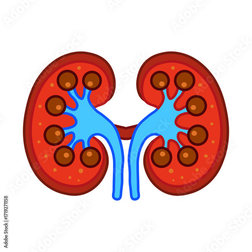 Glomerulonephritis