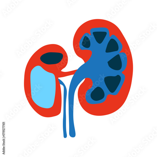 Hydronephrosis