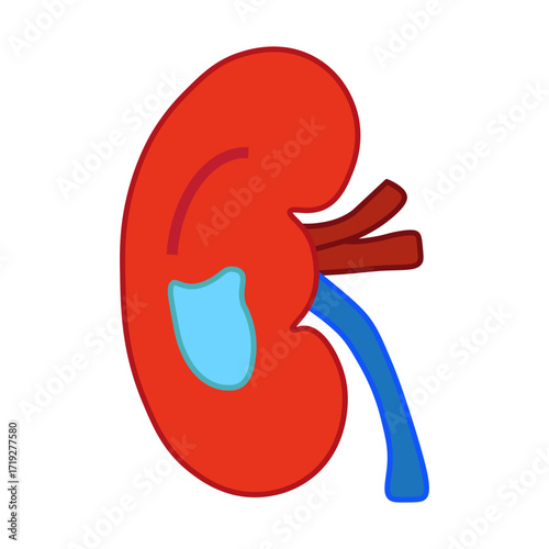 Hydronephrosis