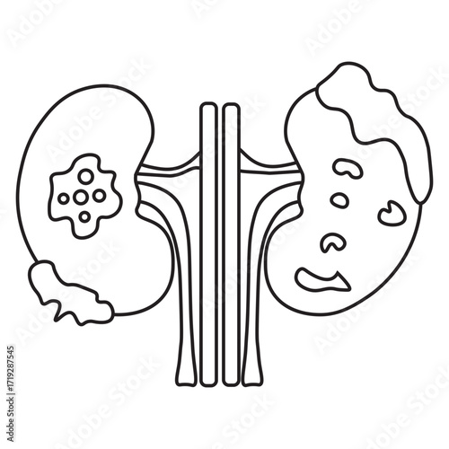 kidney cancer line icon