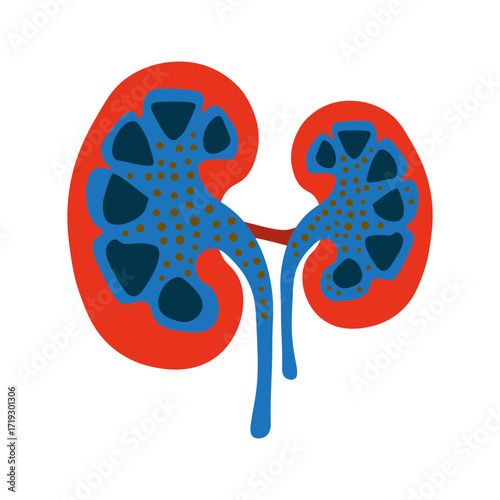 Nephrotic Syndrome