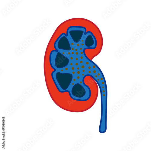 Nephrotic Syndrome