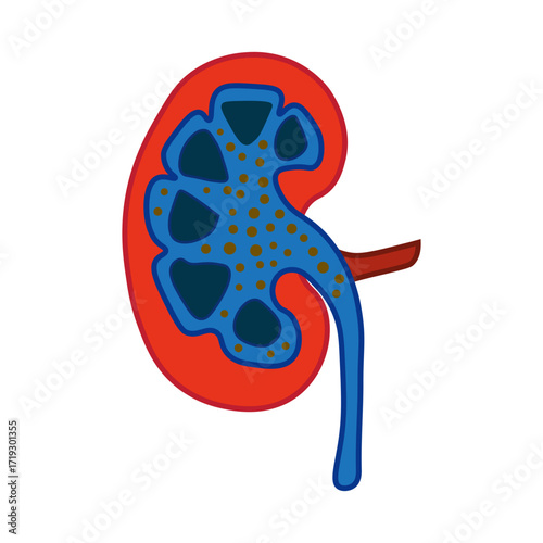 Nephrotic Syndrome
