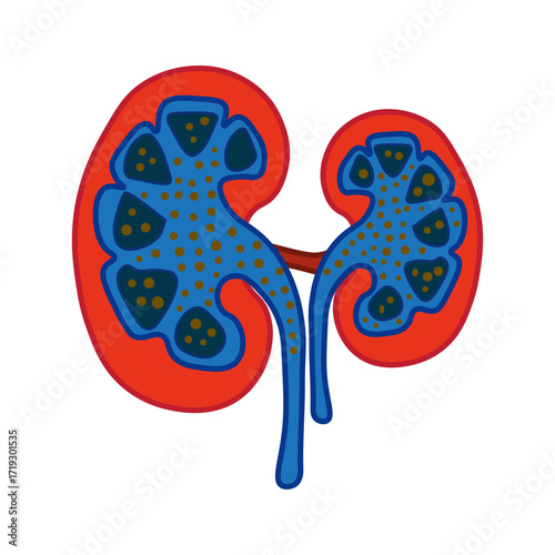 Nephrotic Syndrome