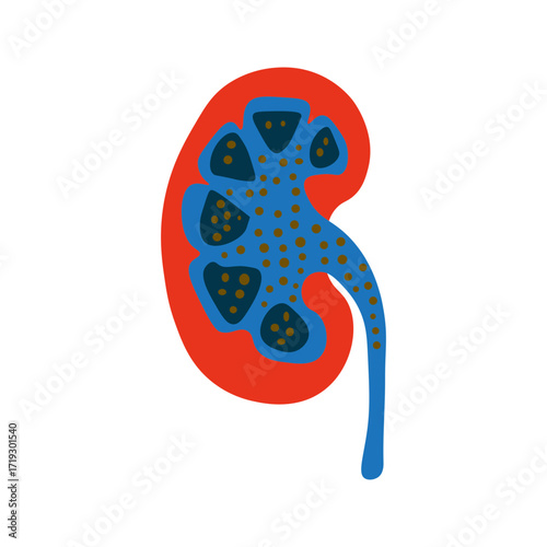 Nephrotic Syndrome