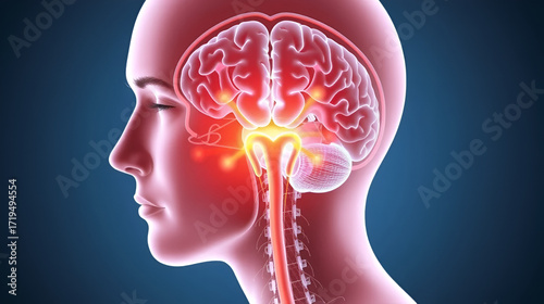 Brain Stem Glioma: The Cranial Nerve Dysfunction and Motor Weakness - Visualize a person with highlighted brain stem showing glioma, experiencing cranial nerve dysfunction and motor weakness
