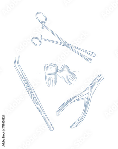 Tooth extraction illustration with dental tools tweezers nippers drawing in graphic style with blue on white background.