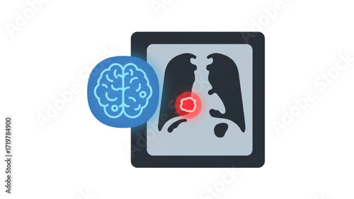 Advanced AI-Powered Lung Cancer Detection: Enhancing Radiology Imaging and Diagnosis Precision