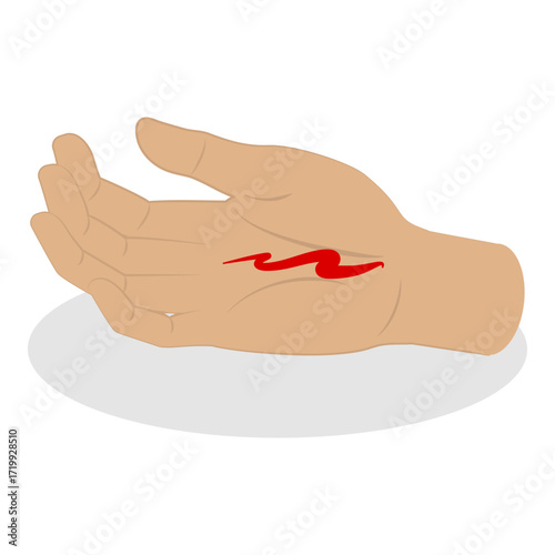 3D Isometric Flat Vector Set of Hand Injury Treatment, Limb Bandaging Instructions. Item 3