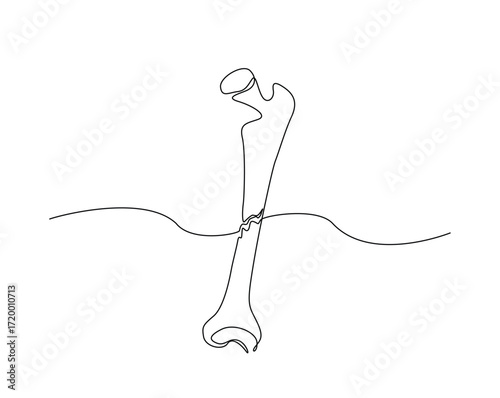 Broken bone outline illustration. Continuous line drawing of broken human bone.