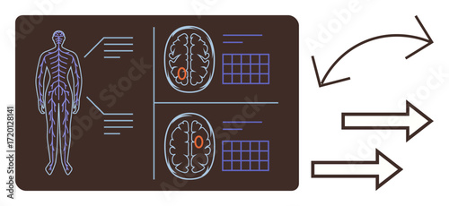 Human anatomical chart with nervous system and brain diagrams alongside directional arrows. Ideal for neuroscience, medicine, education, data flow, analysis, diagnostics, research, simple flat