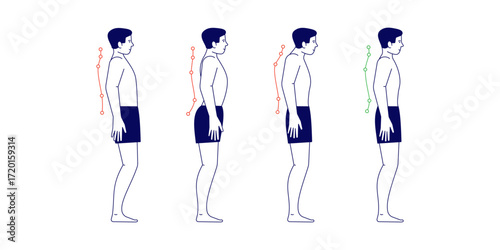 Posture Vector Icons, Posture Correction, Healthy Posture, Posture Exercises, Posture Alignment, Posture Illustration, Posture Therapy, Posture Icon Set, Posture Awareness, Posture Wellness