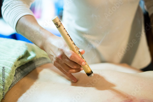 Moxibustion therapy. Healthcare and wellness treatment for the body. Patient with moxibustion smoke therapy of expert hands