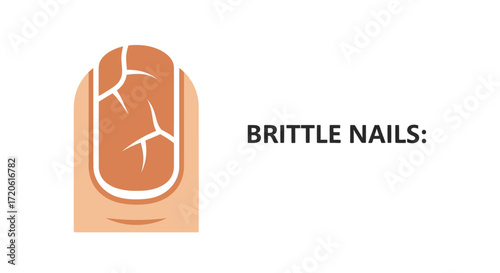 Brittle nails indicating a weak nail bed, highlighting the importance of nail health and care.