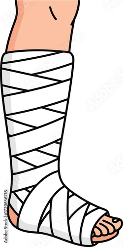 Injured leg wrapped in white bandage showing foot and ankle with skin tone top vector