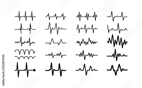 A collection of various EKG and ECG heartbeat waveforms showing different heart rhythms and cardiac signals on a white background.