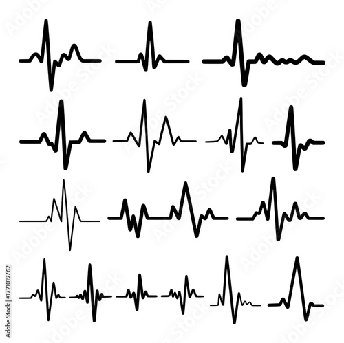 Collection of Diverse Electrocardiogram (ECG) Heartbeat Waveforms