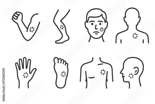 Linear icons of rash symptoms on various body parts