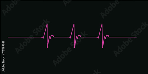 Medical technology displays a healthy heartbeat on an EKG monitor with a distinct wave and steady pulse rate graph