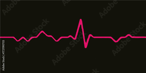 Digital electrocardiogram graph with a pulsing heartbeat line on a medical monitor