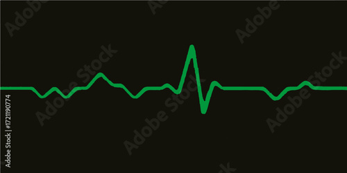 A medical ecg cardiogram monitor displaying a green heartbeat wave illustration