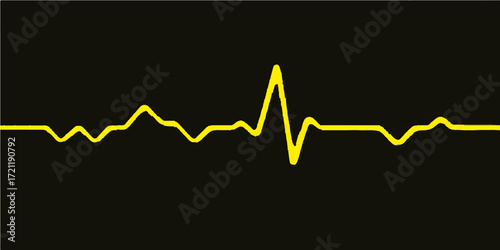 Medical heartbeat cardiogram showing a pulsating green line on a hospital monitor screen, representing a patient's life signs