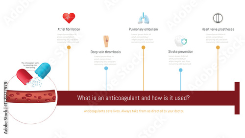 Anticoagulant drug preventing blood clot formation infographic