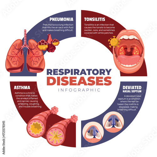 Flat Educational Infographics of Common Respiratory Diseases