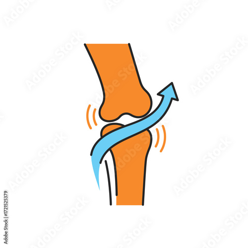 A colorful medical illustration showcasing a human knee joint undergoing a twisting movement, representing common injuries, sprains, or arthritic conditions.