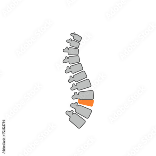 This clear medical illustration showcases a human spinal column with a single vertebra highlighted in orange, representing an area of pain, injury, or focus.