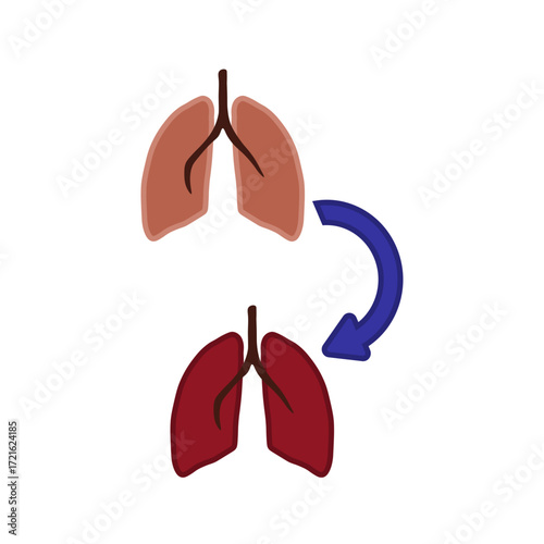 Lung Transplant