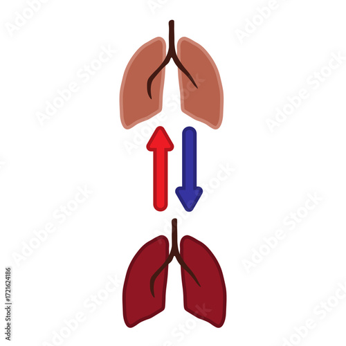 Lung Transplant