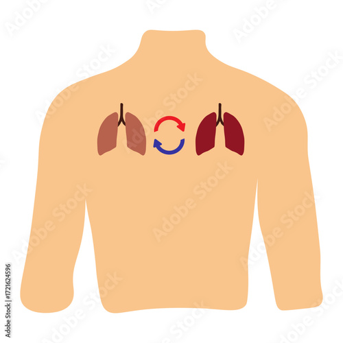 Lung Transplant