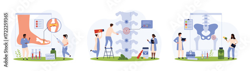 Diagnosis and treatment of osteoarthritis, rheumatoid arthritis set. Tiny people research with xray and medical charts inflammation of foot and hip joint, spinal cartilage cartoon vector illustration
