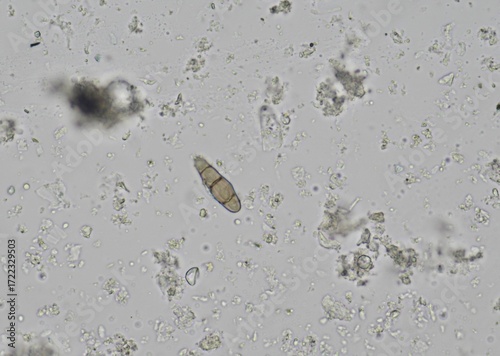 Fotografie soil microorganisms under a microscope including amoeba, flagellates, nematodes,