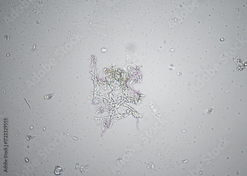 soil microorganisms under a microscope including amoeba, flagellates, nematodes, fungi, bacteria	
