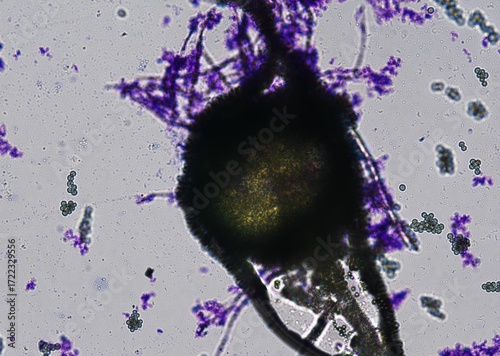 soil microorganisms under a microscope including amoeba, flagellates, nematodes, fungi, bacteria	
