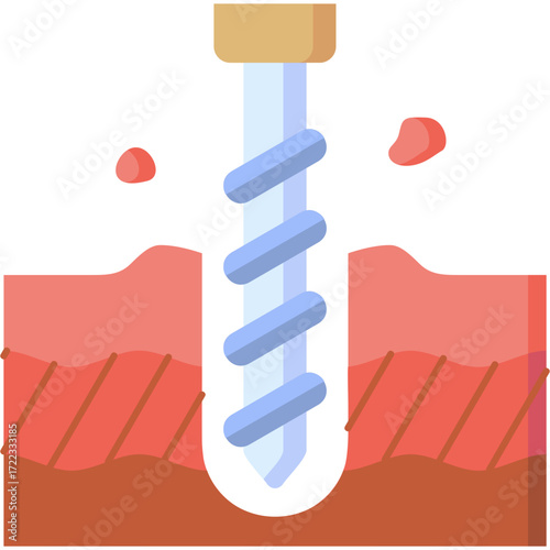 Drilling Illustration