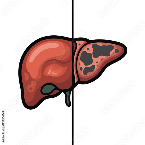 Healthy vs. Cancerous Liver
