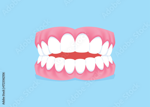 Full mouth teeth - Openbite illustration vector design. Dental care concept.