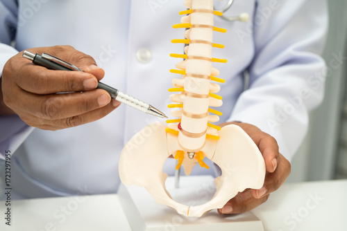 Fotografía Asian doctor holding spinal nerve and bone model, Lumbar spine displaced herniated disc fragment for treatment medical in the orthopedic department