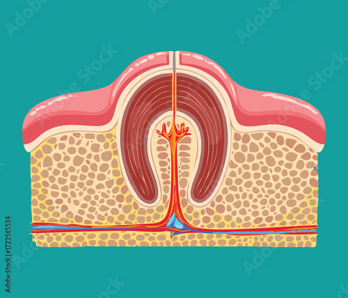 A longitudinal cross-section diagram of a tooth with a periapical abscess, showing pus formation and inflammation at the root apex within the jawbone	