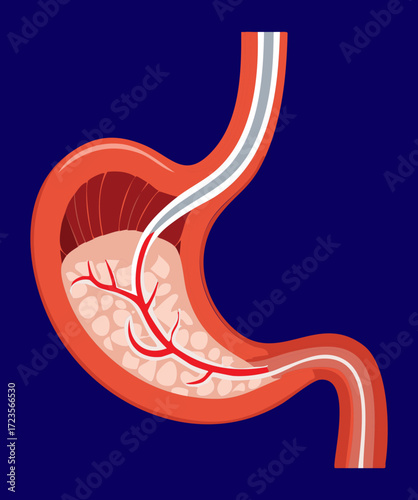 Detailed diagram of the stomach and esophagus, illustrating the churning of partially digested food and gastric acid inside	