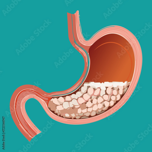 Anatomical Diagram of the Stomach Processing Undigested Food Particles Requiring Further Action for Complete Nutrient Absorption	