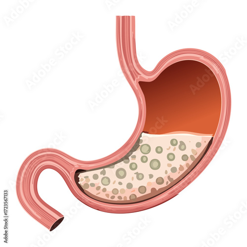 The Process of Food Digestion in the Stomach Showing Chyme Moving Towards the Duodenum and Intestinal Tract	